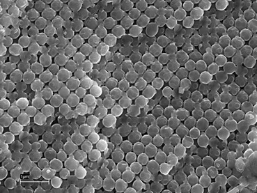 Elektronenmikroskop-Aufnahme des Kugelgitters